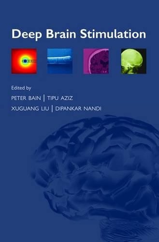 361° Deep Brain Stimulation by Peter Bain (English) Paperback Book