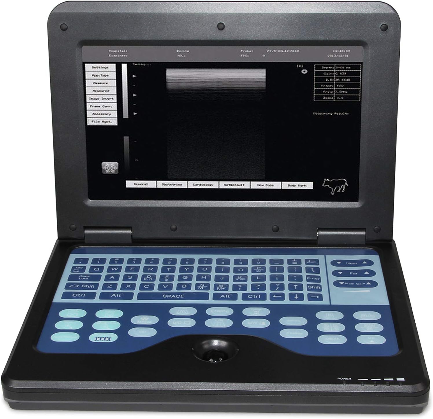 MEUBON Portable Ultrasound Scanner I Ideal for Cattle, Horse, Camel, Equine, Goat, Cow, and Sheep I Includes 7.5 MHz Rectal Probe I Model MS600P2V